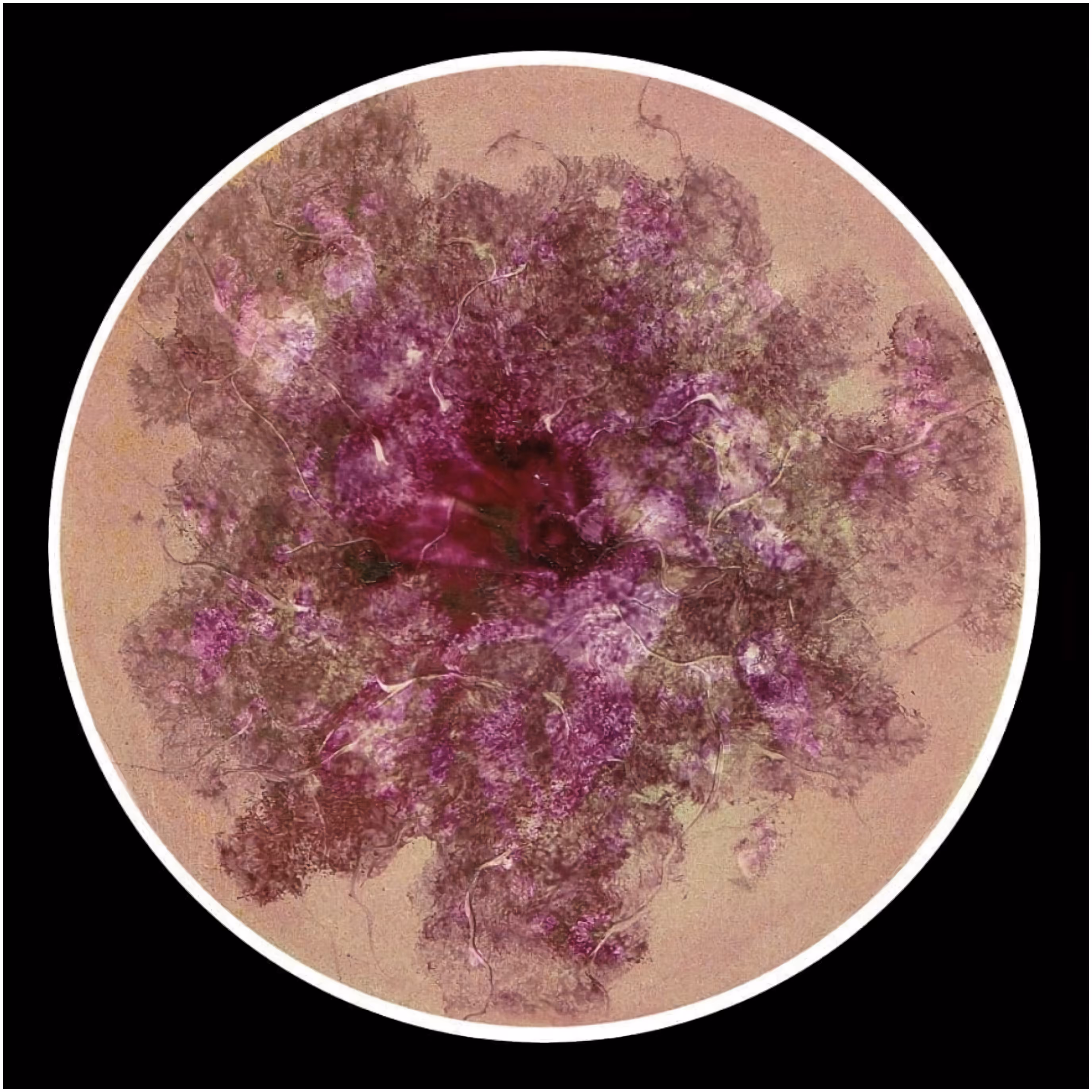 Ⅰ : Magenta auricle
