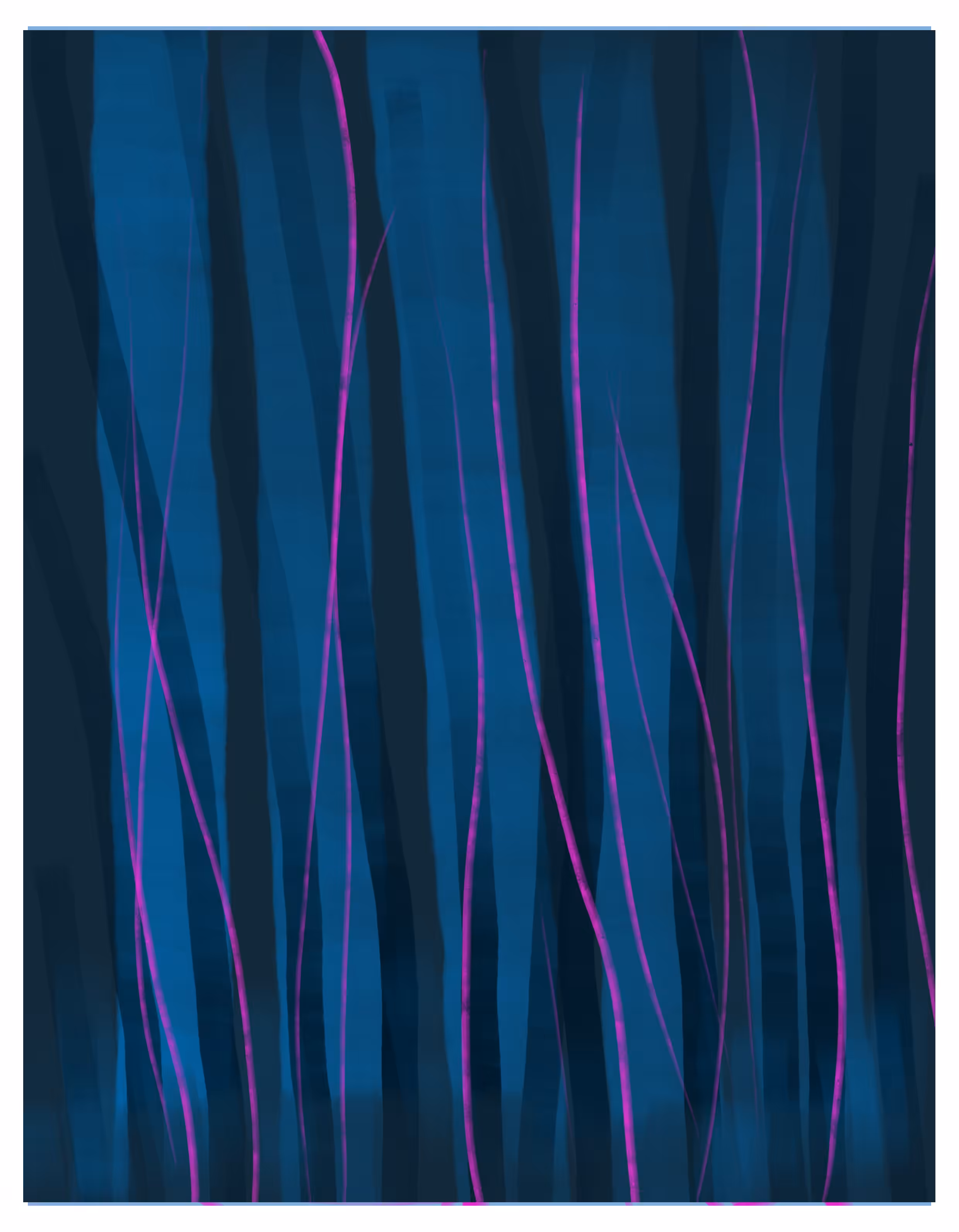 NT_11