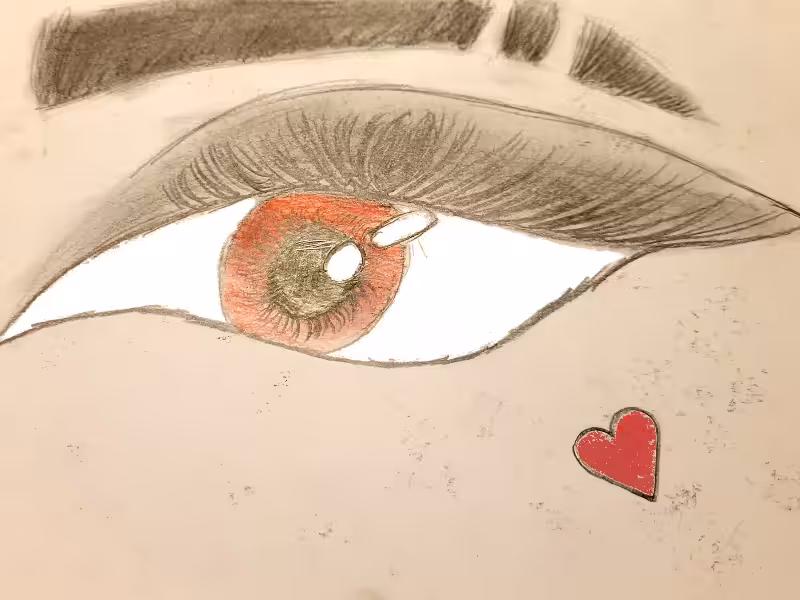 Eye Won