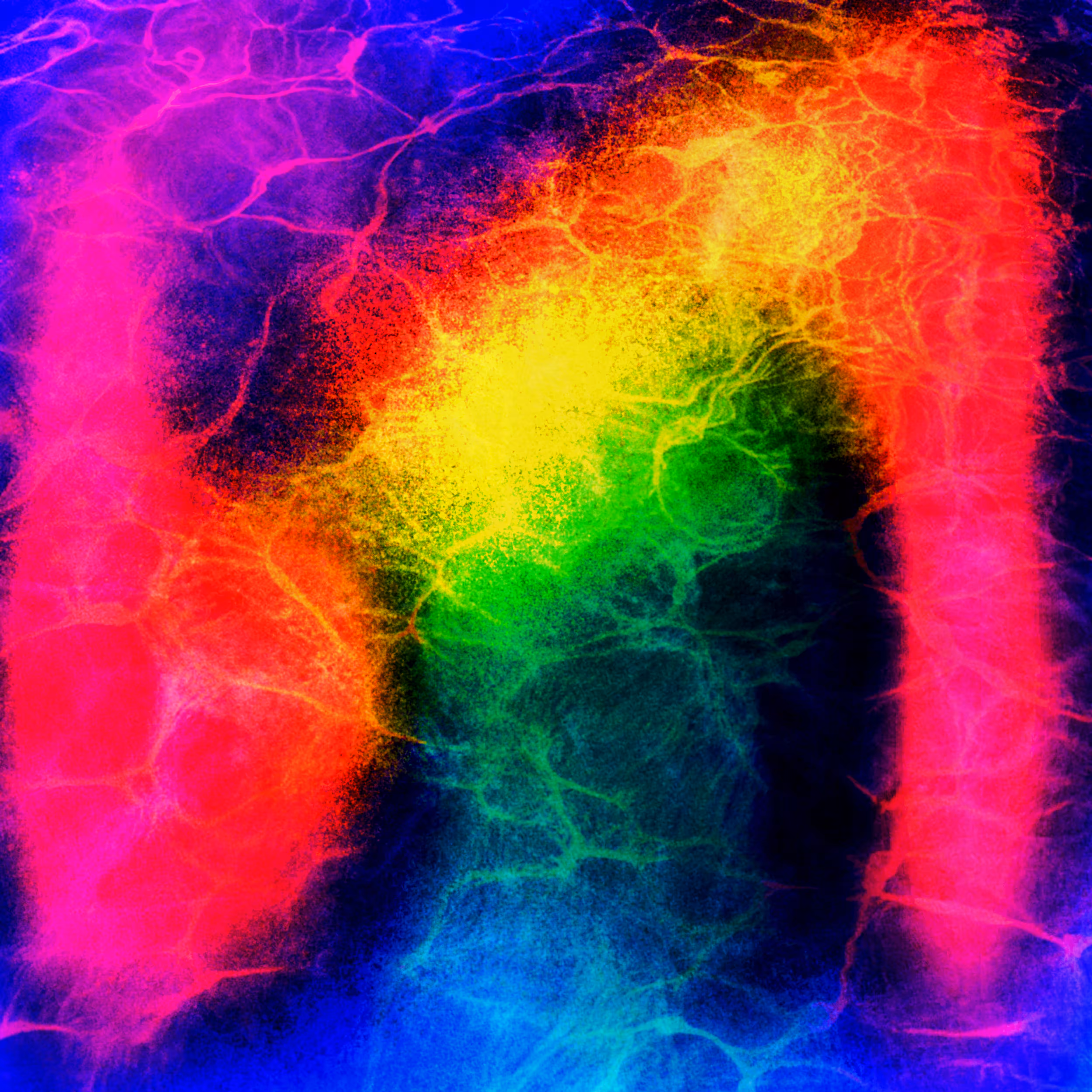 NeuroDiversity 1