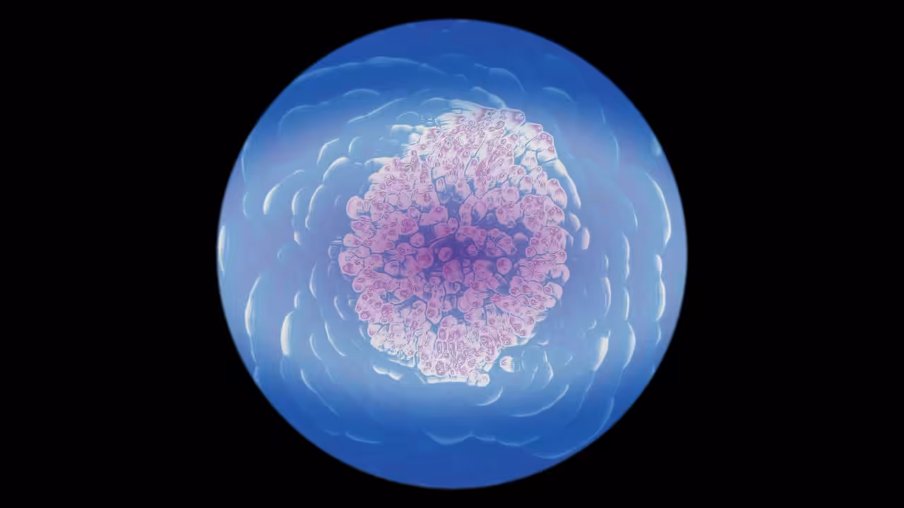 jellyfish bloom #2