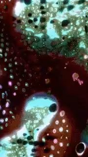 cyanea