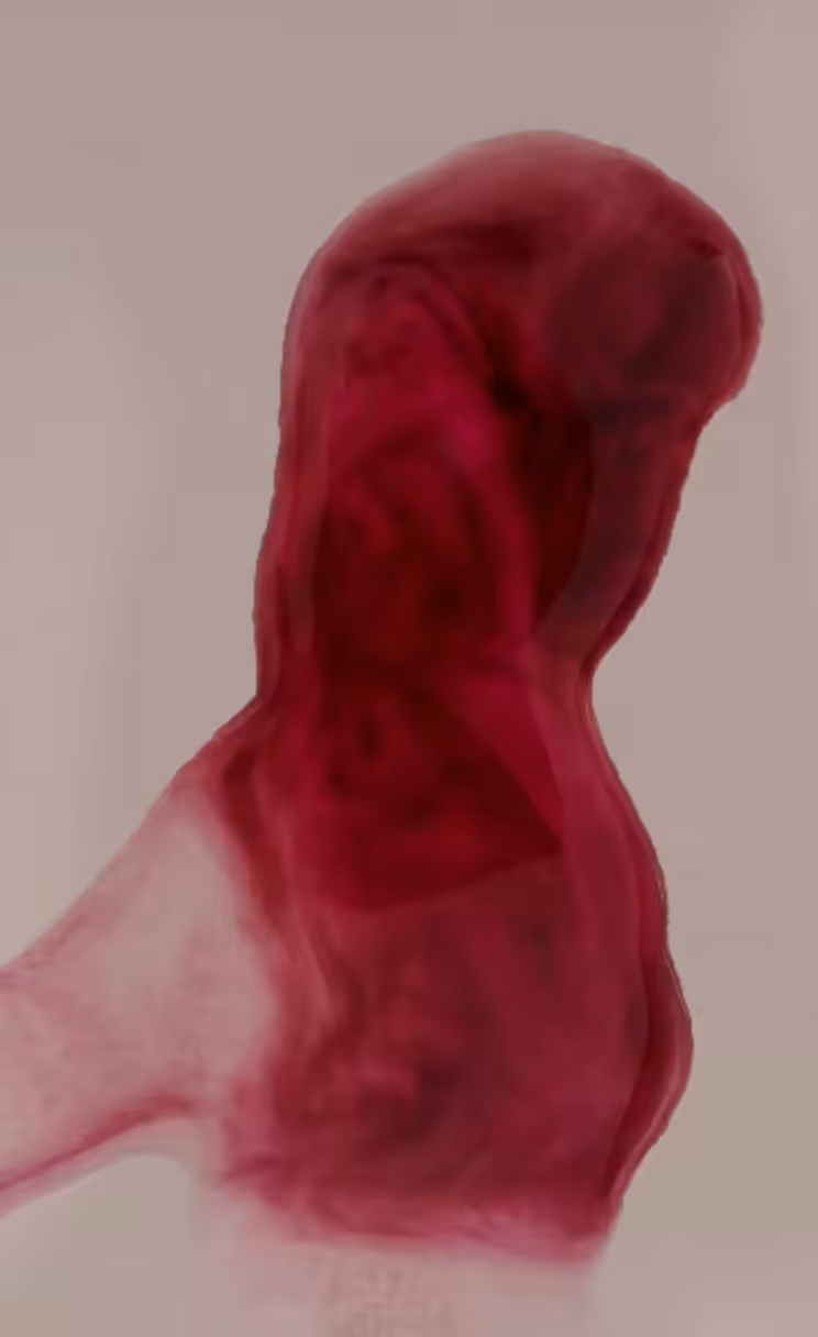 LOVOTIC – V
