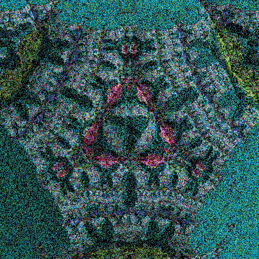 Lichenoid forms #13