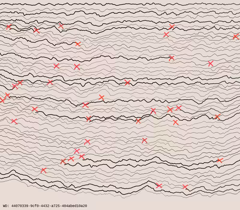 Wall Drawing #6