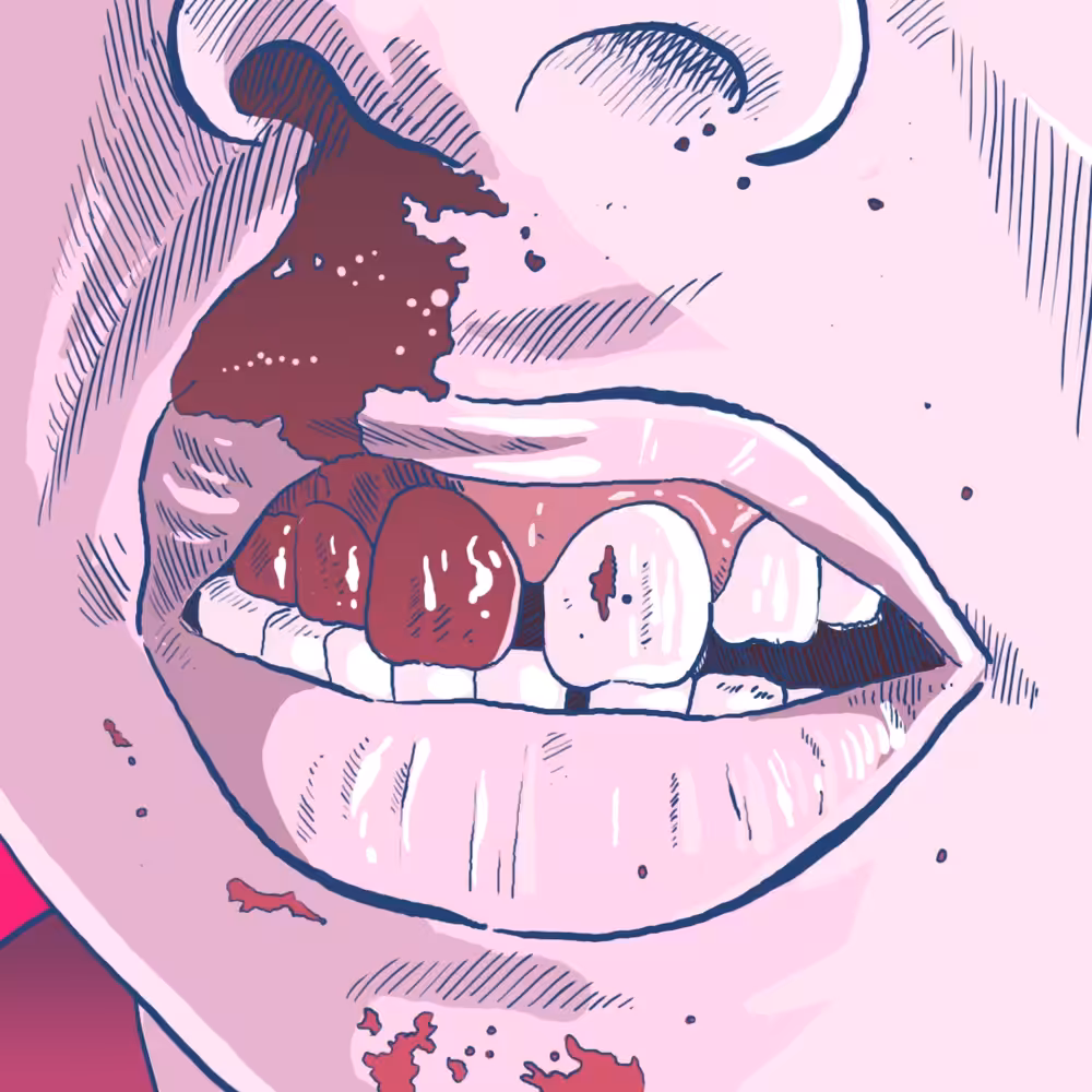 Busted Nose
