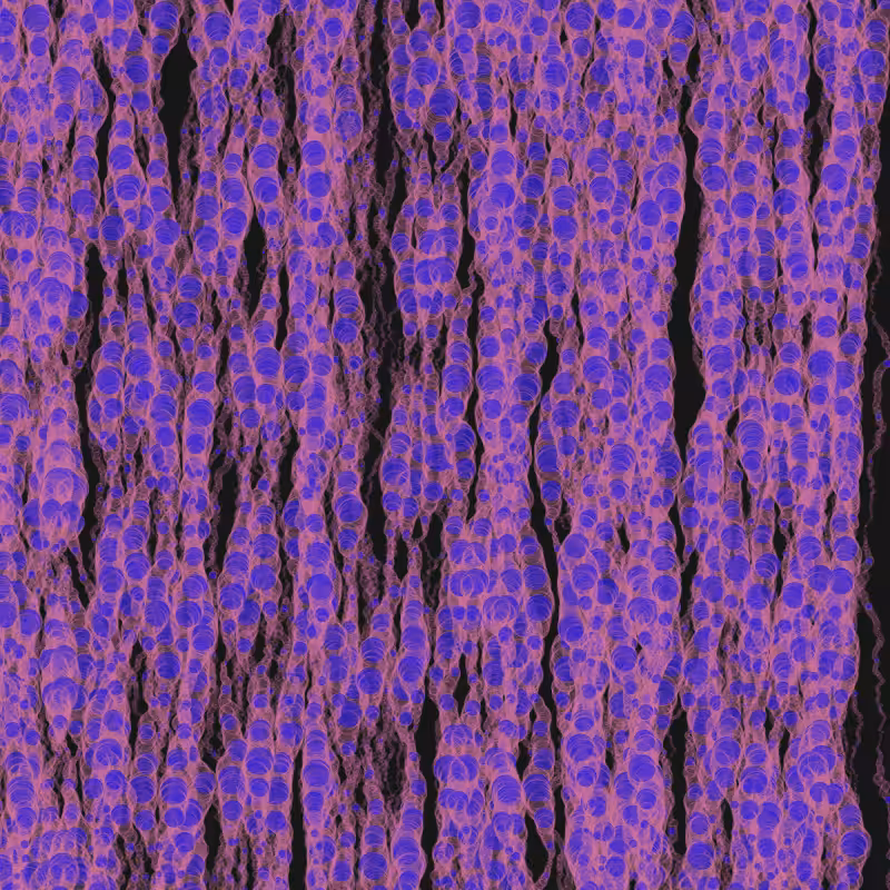 Sasnak Egg Pods #34