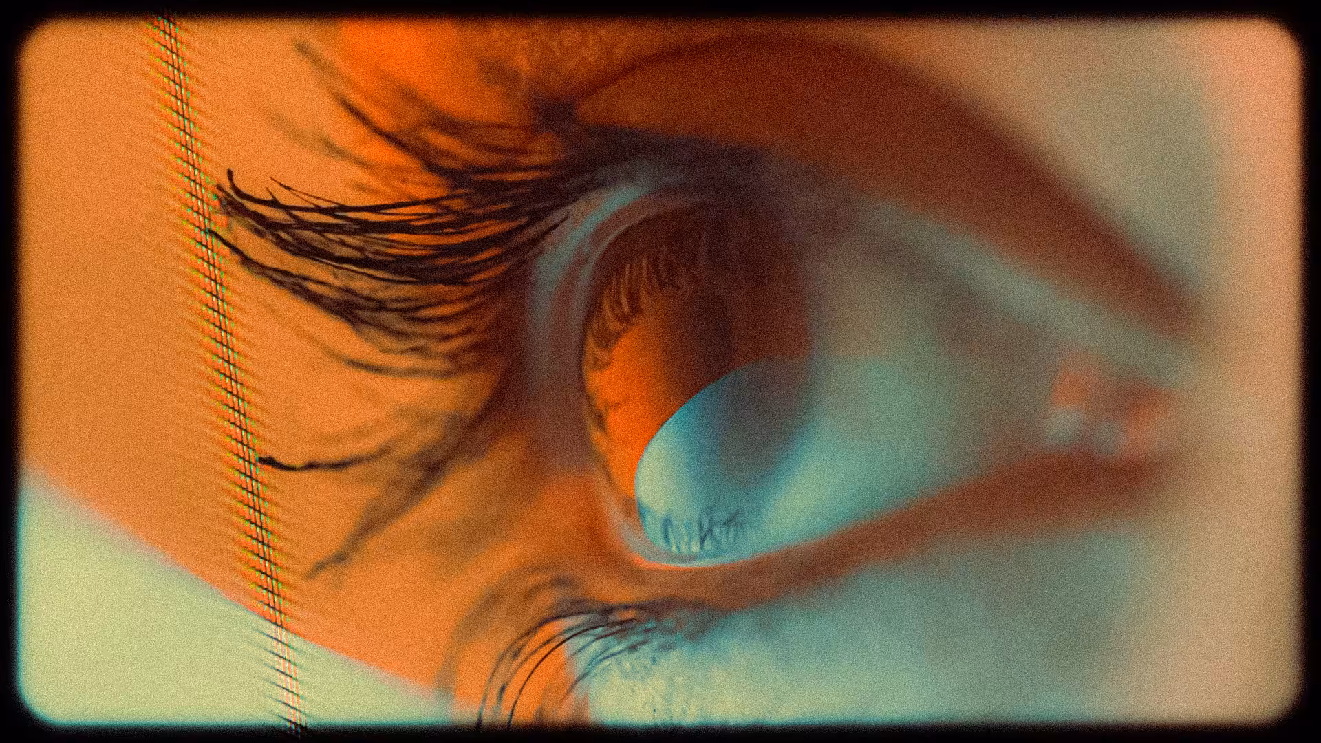 Corneal Suicide