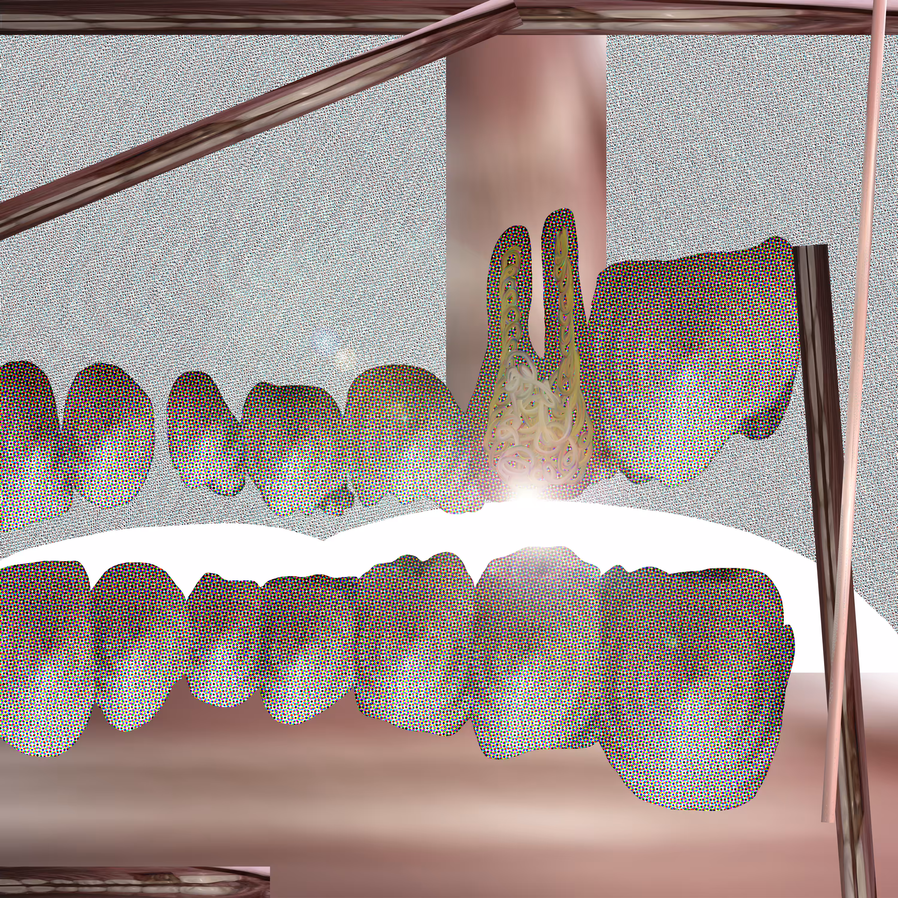 Pieza dental 17