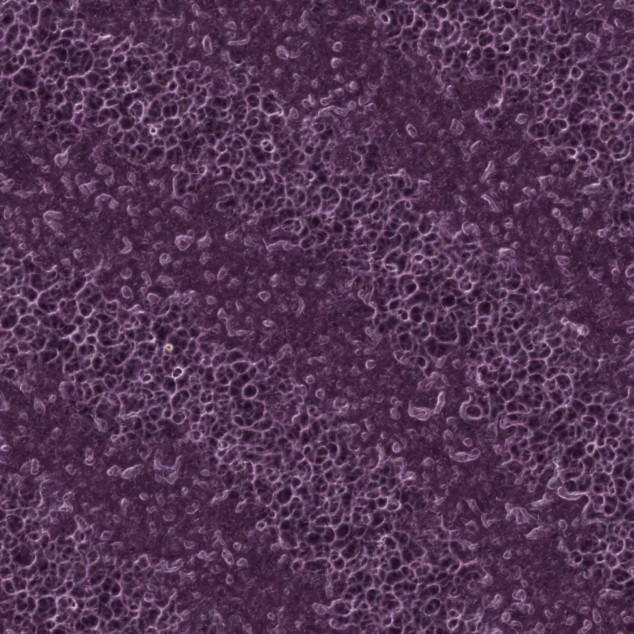 saprophyte #156