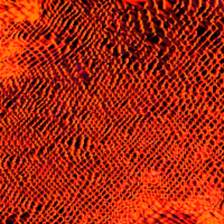 Radio Gel #47