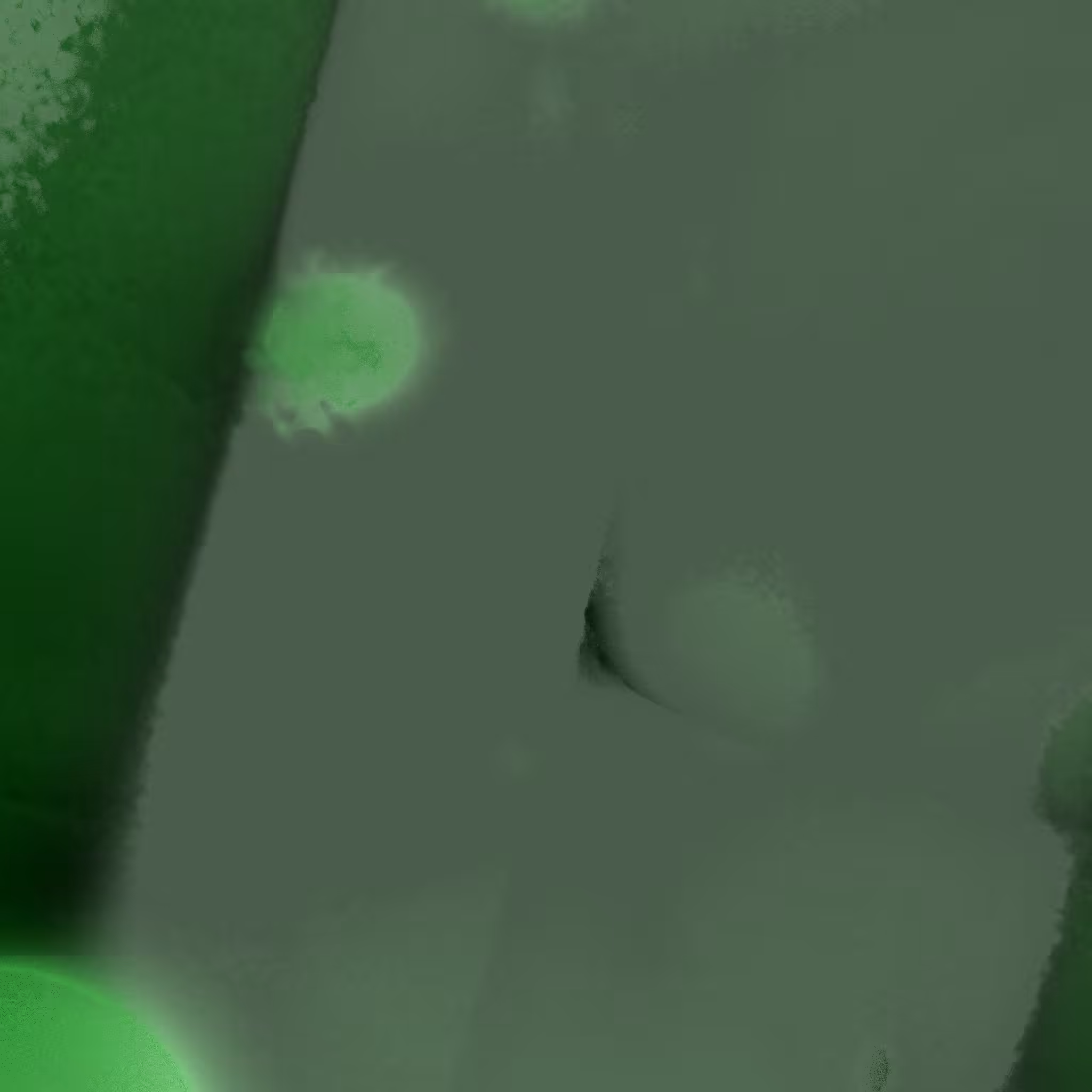 Ataraxis #473