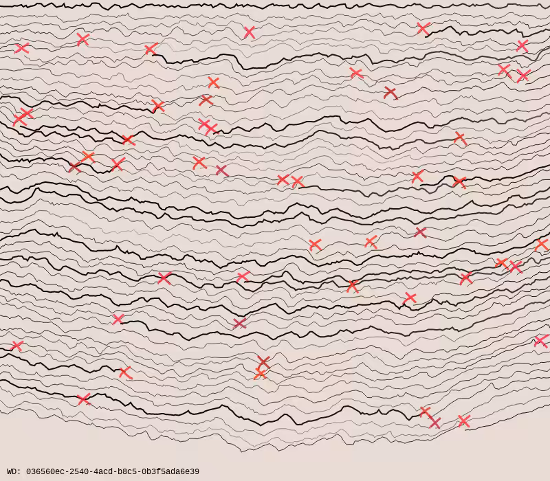 Wall Drawing #11