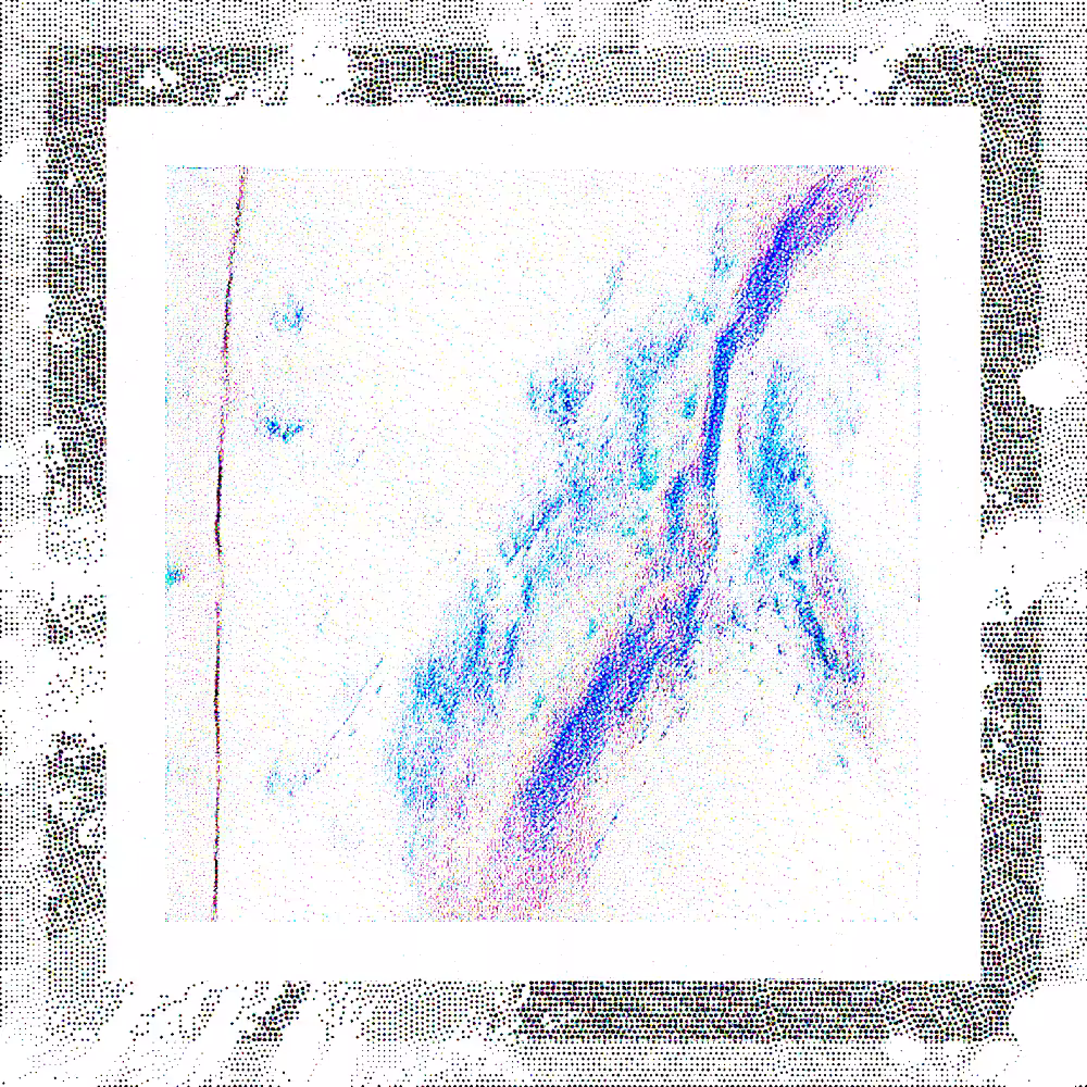 CHX-1 #204