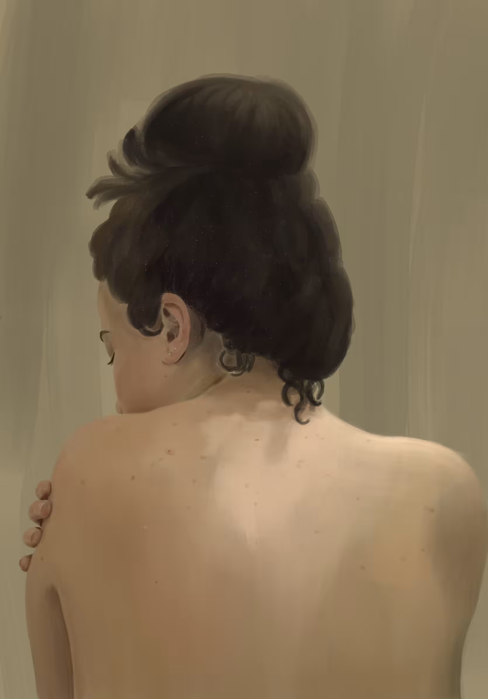 Scars 