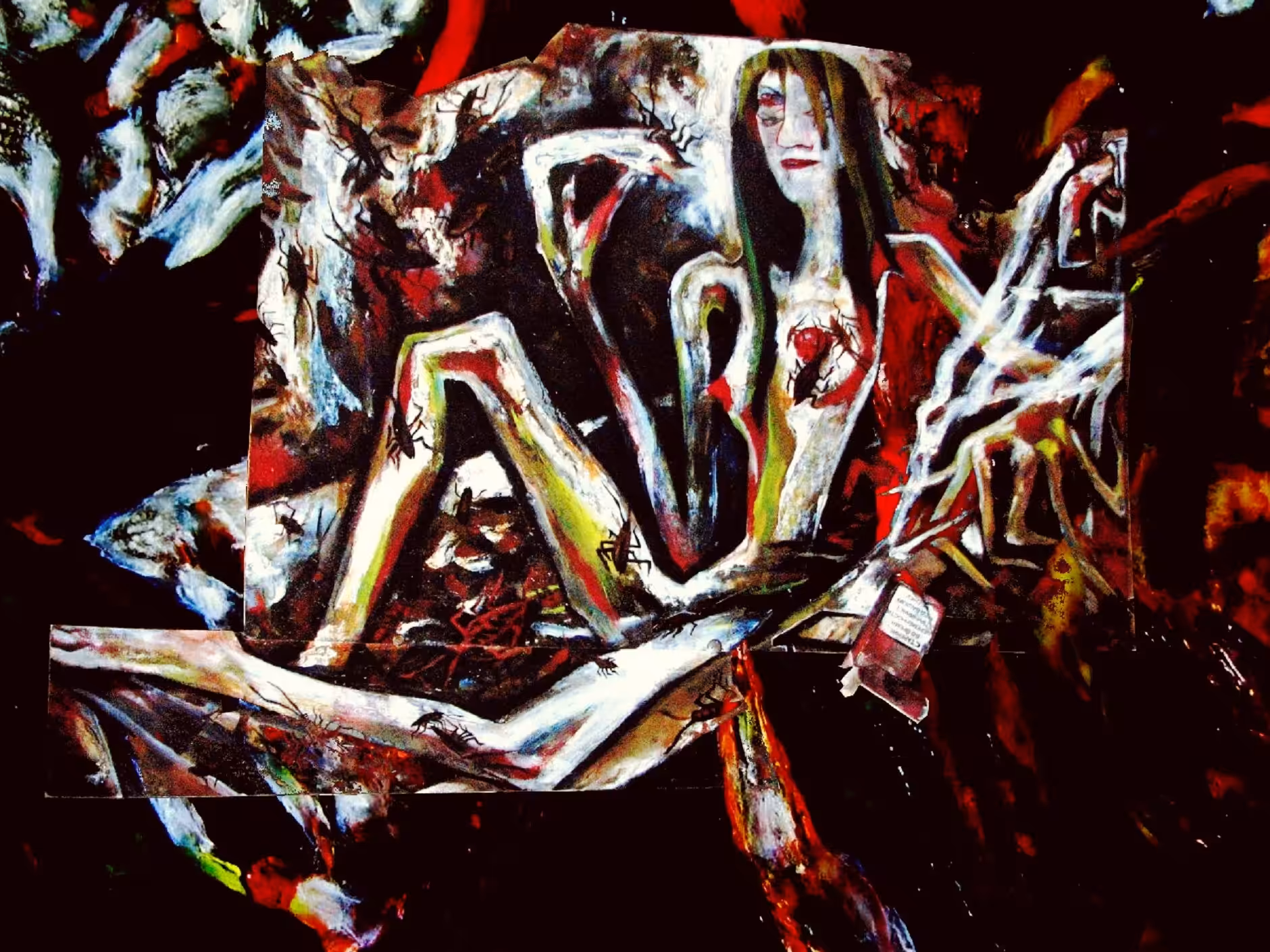 Anorexia nervosa