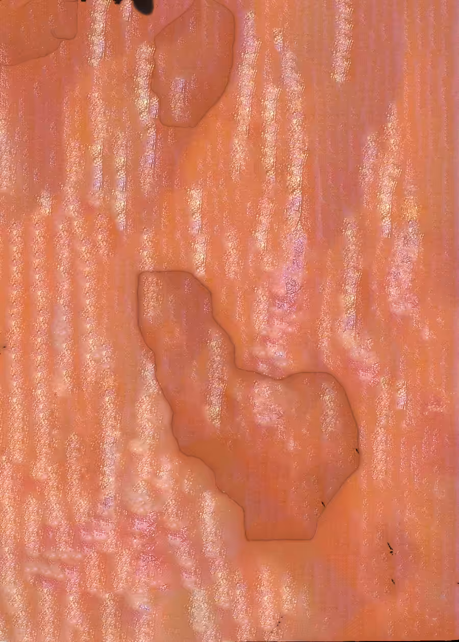 GSYNW_010
