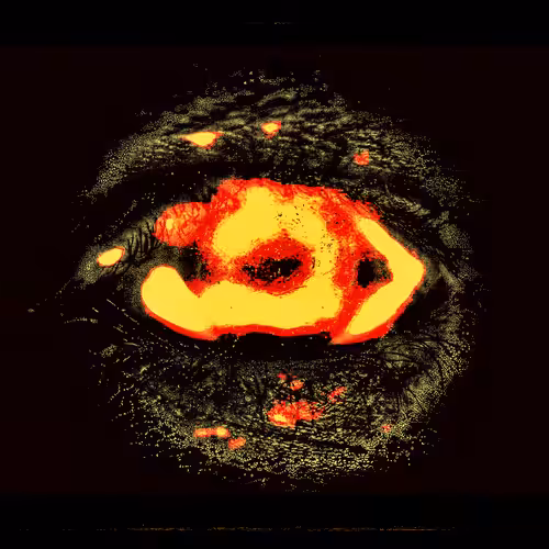 Eye #1