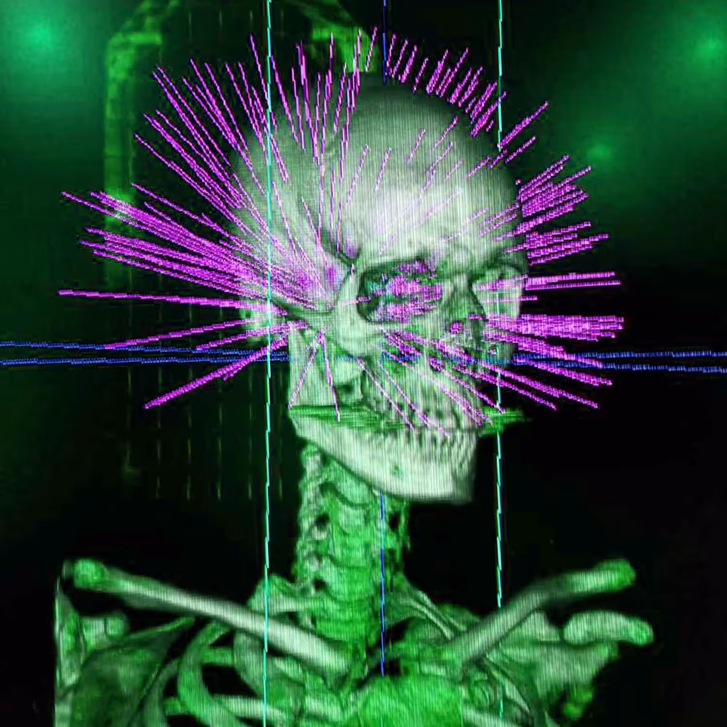 "Brain Scan Man" Brain Tumor NFT