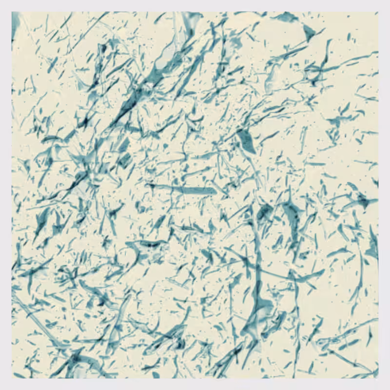 Dynamical System #3