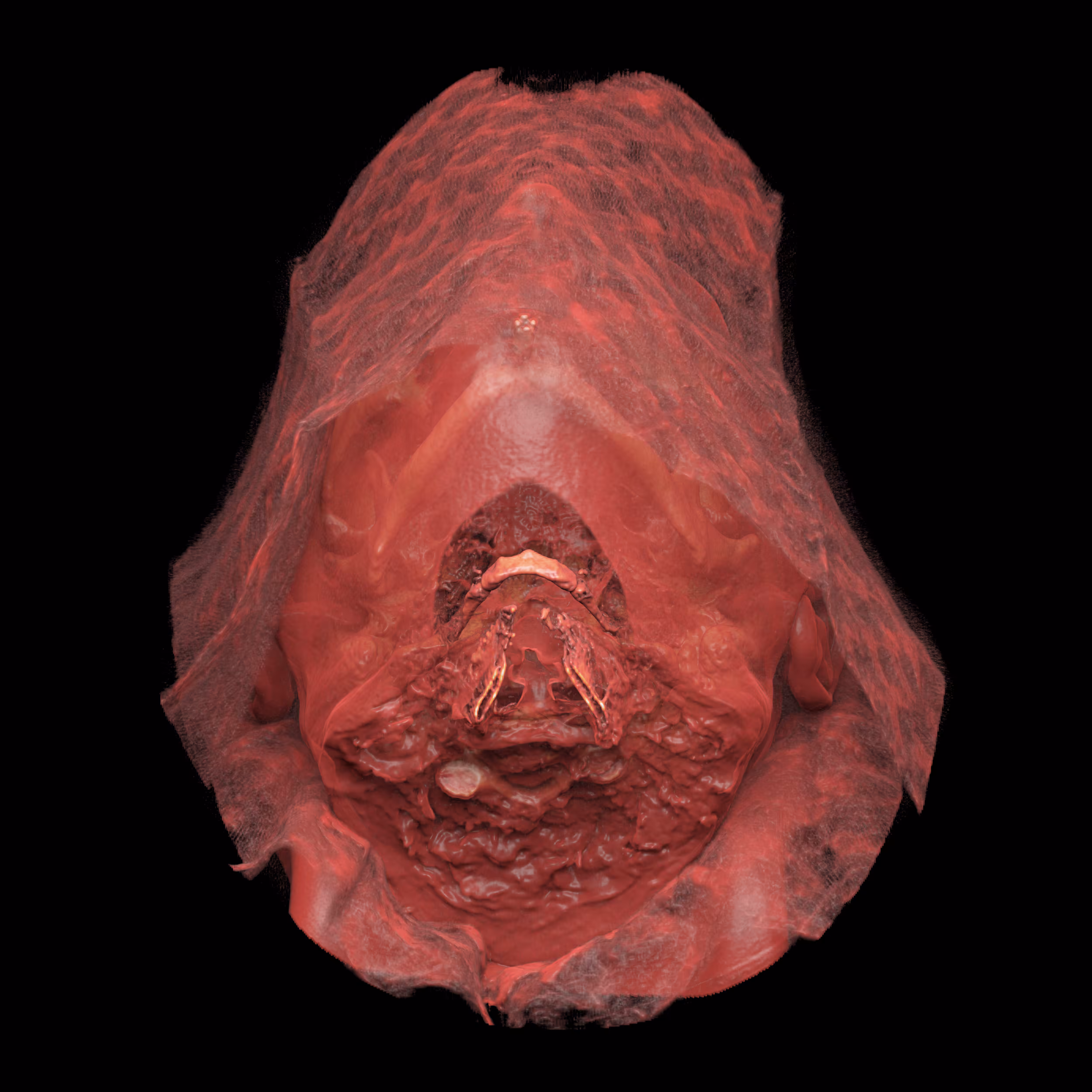 Anonymized 07
