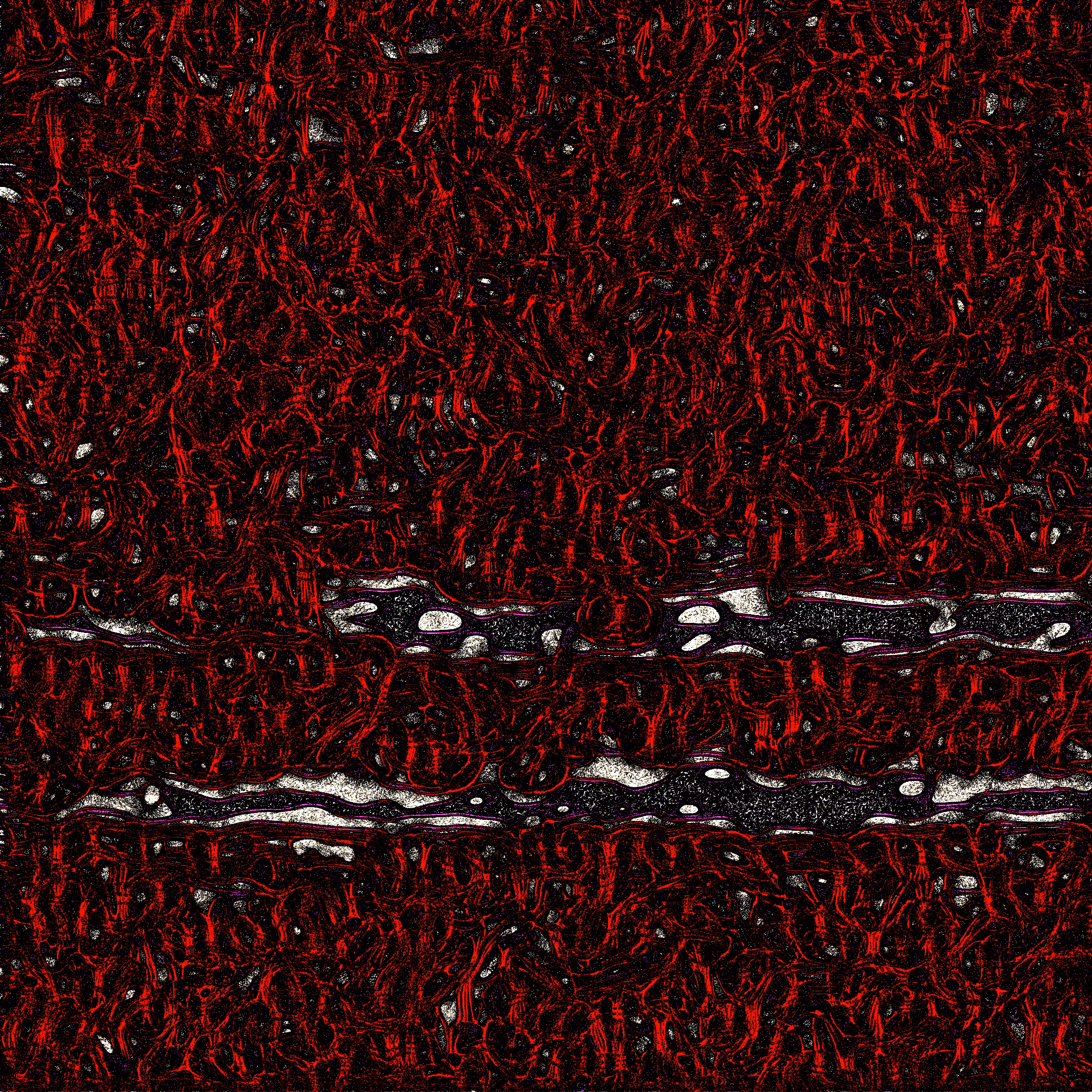 Abstract A3