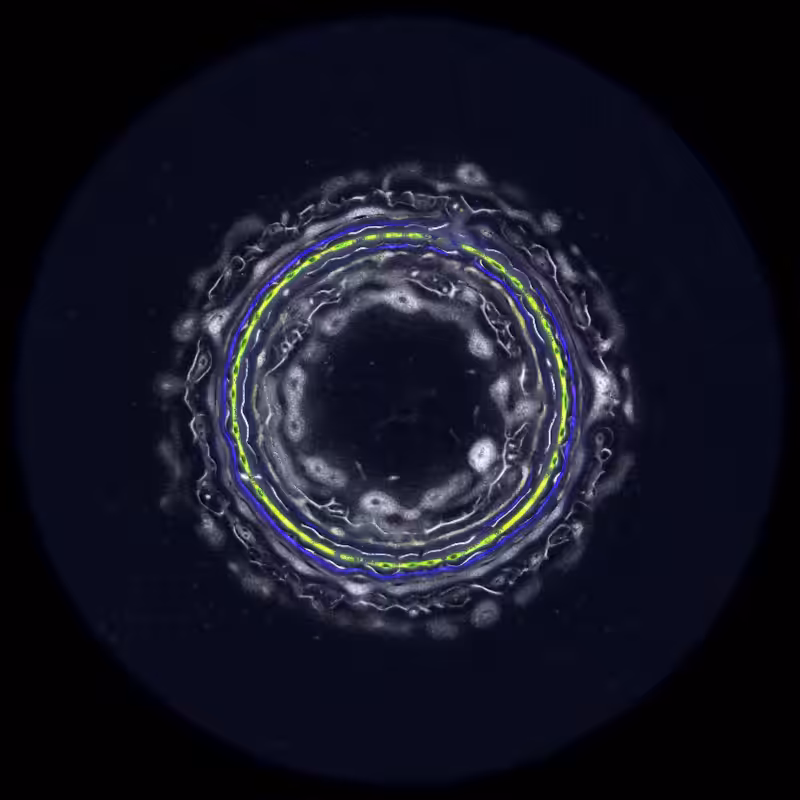 Ethereal Microcosm #187