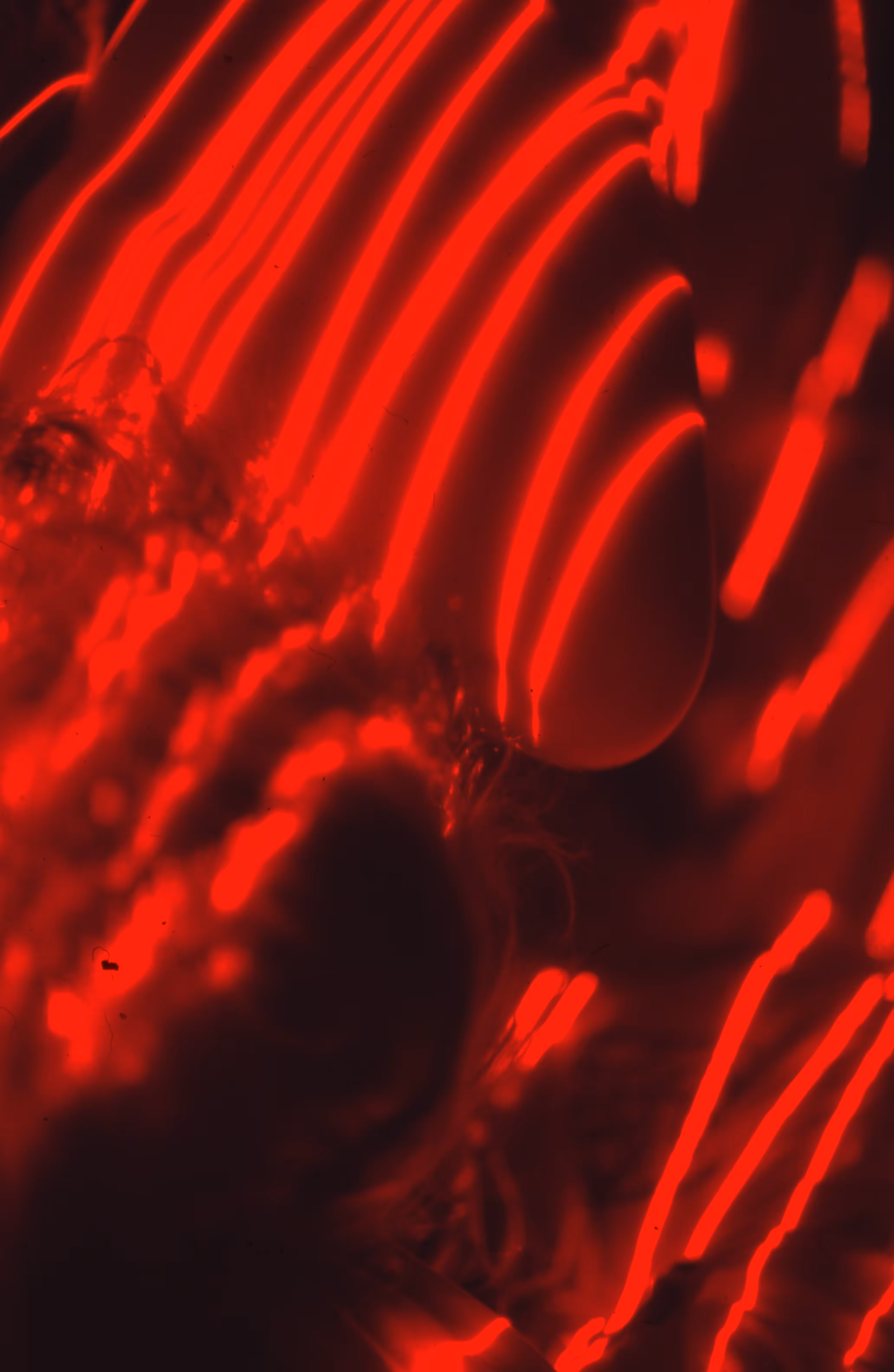 LASER II