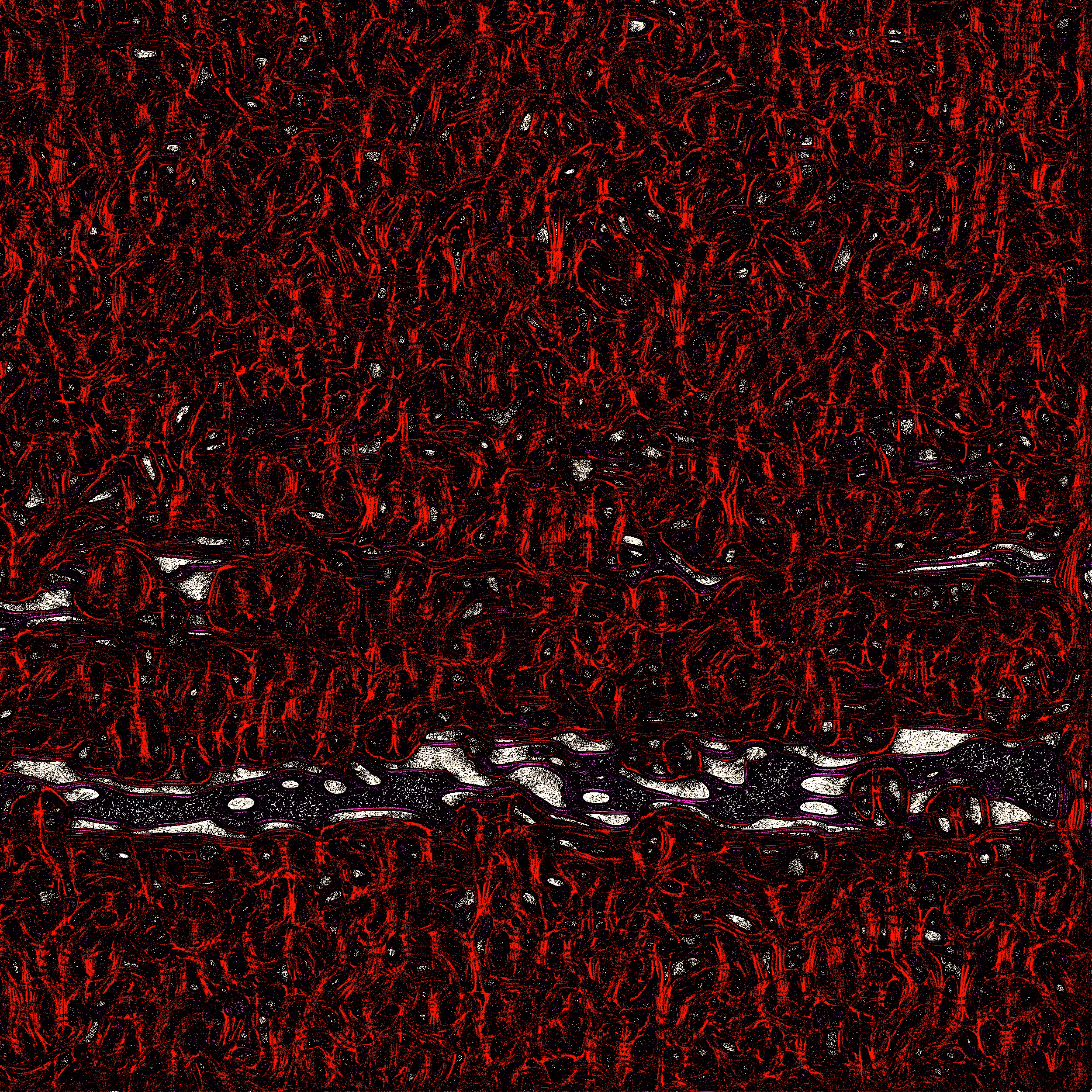 Abstract A4