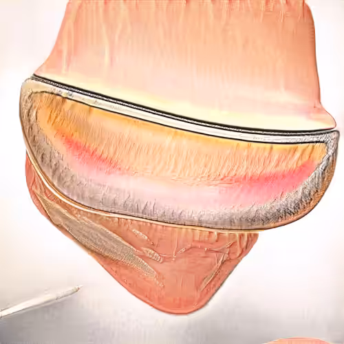 Fountain 0000237