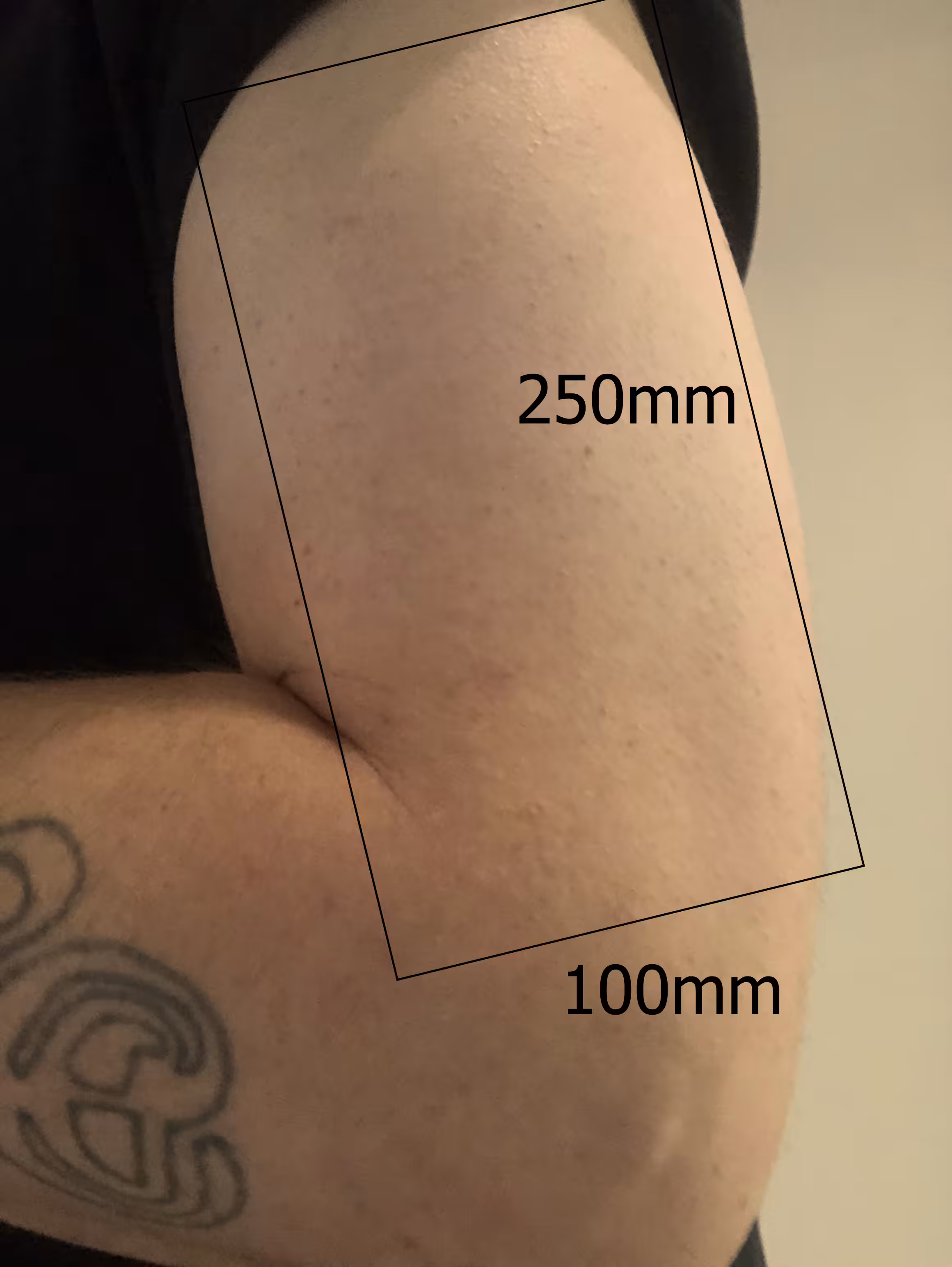 Lot #15 [100mm x 250mm - Left Outer Bicep]