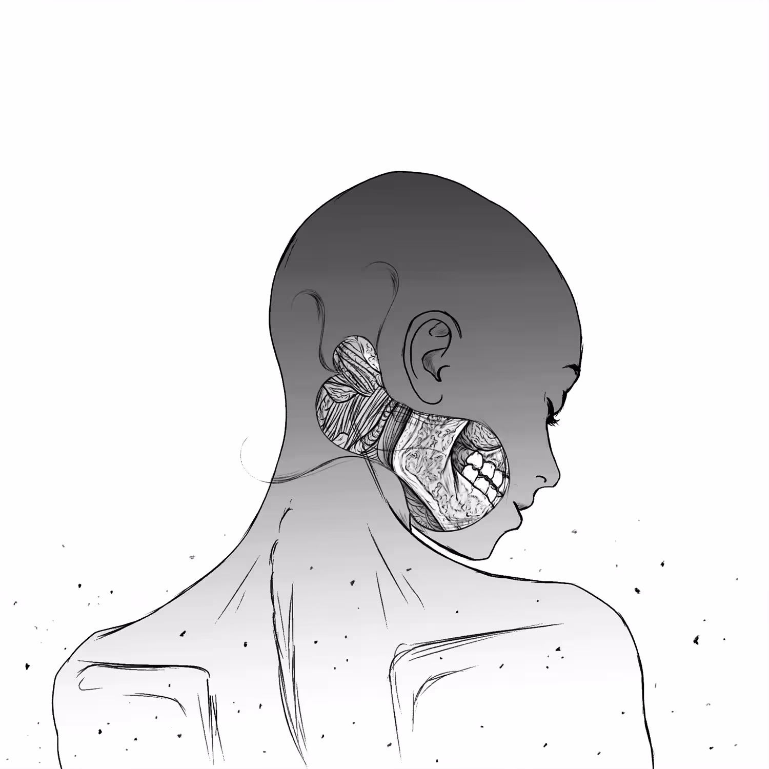 Scar
