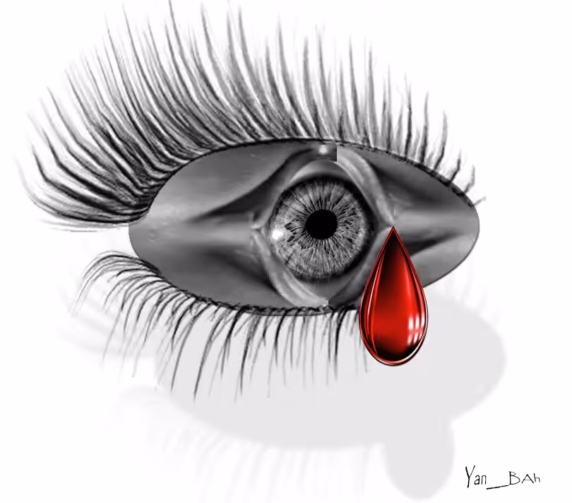 Tear