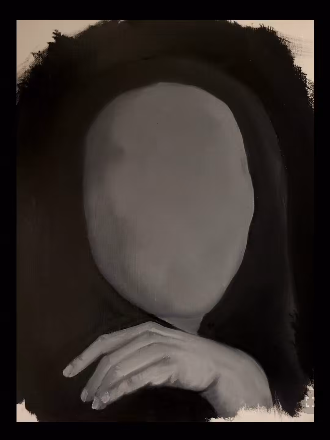 Metacarpus #1
