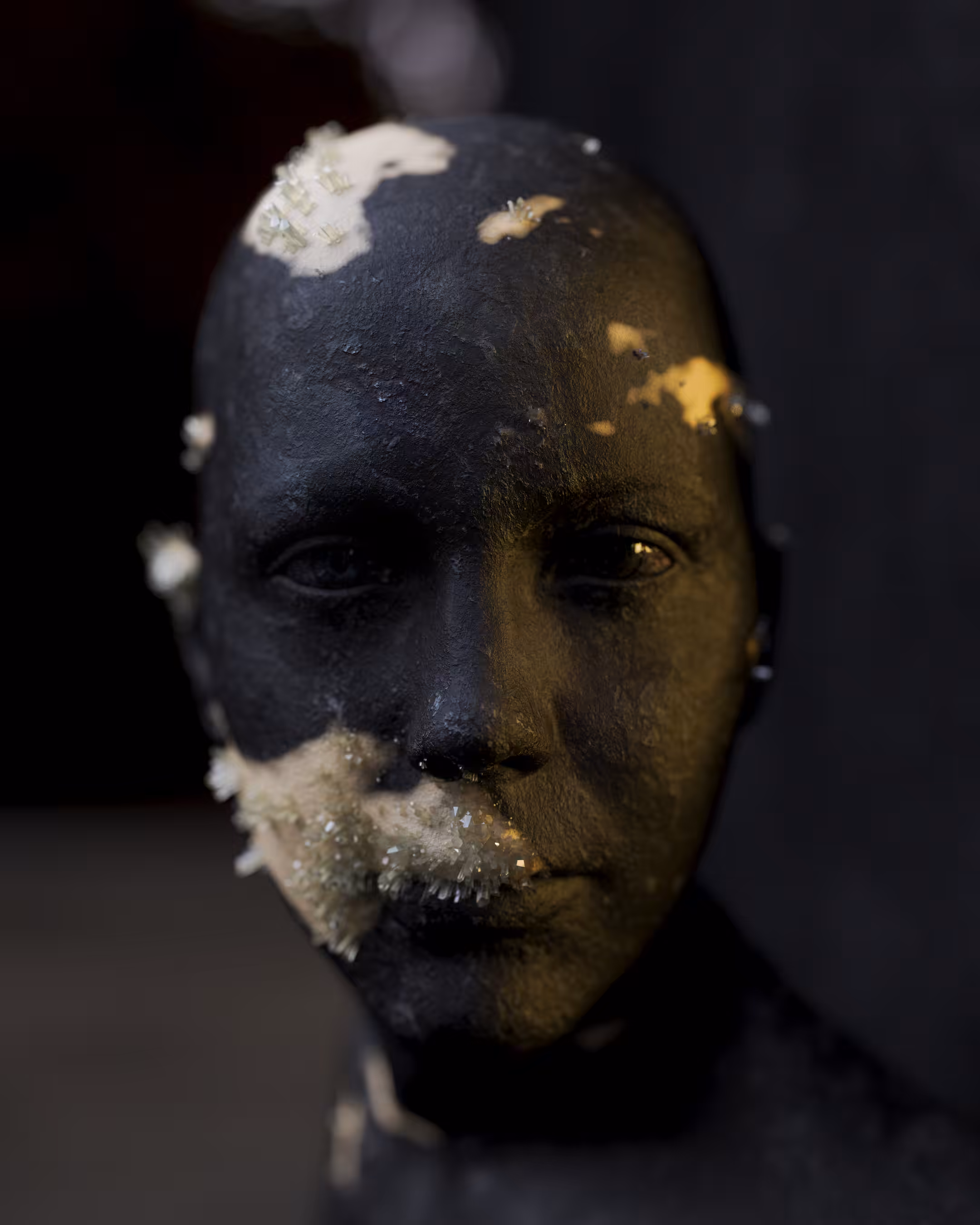 Vitiligo 