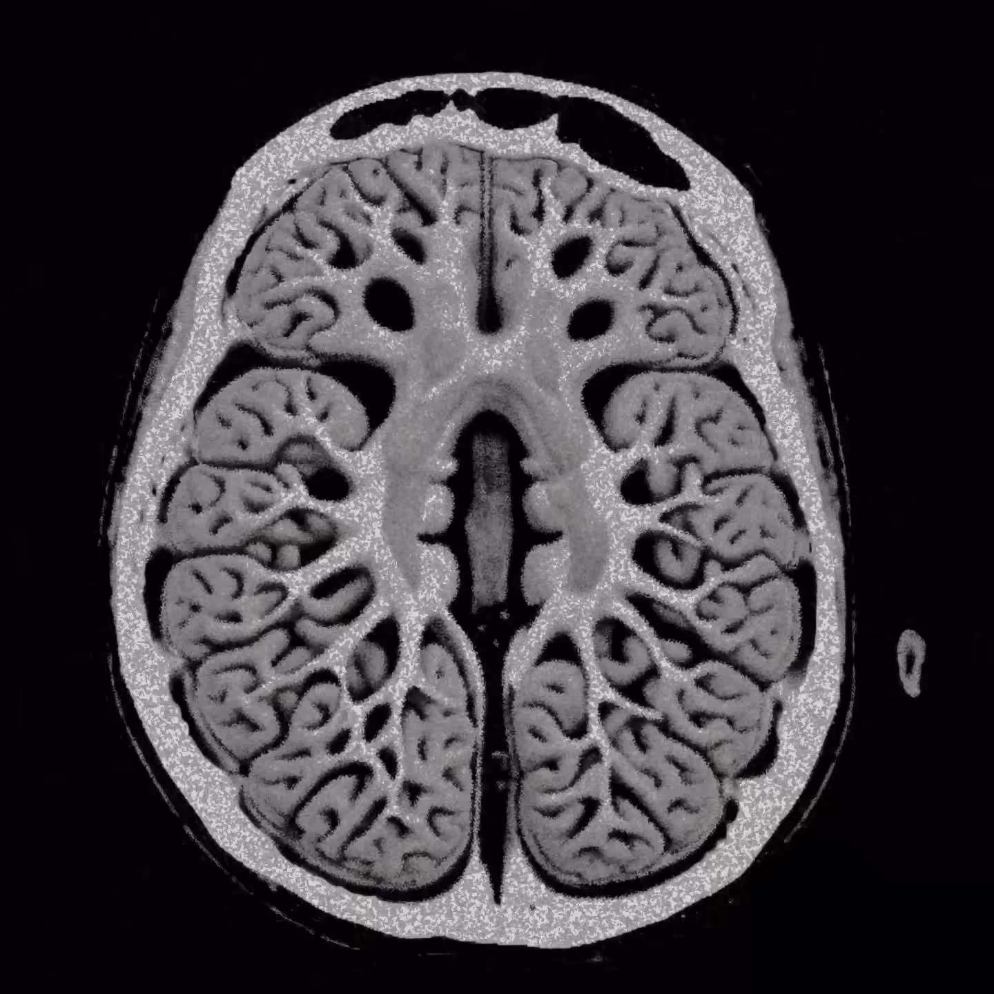 AX_brain_neurocoil_recon(7)_REV.ai
