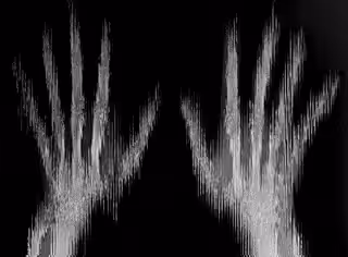 X-RAY