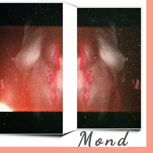 MONDO