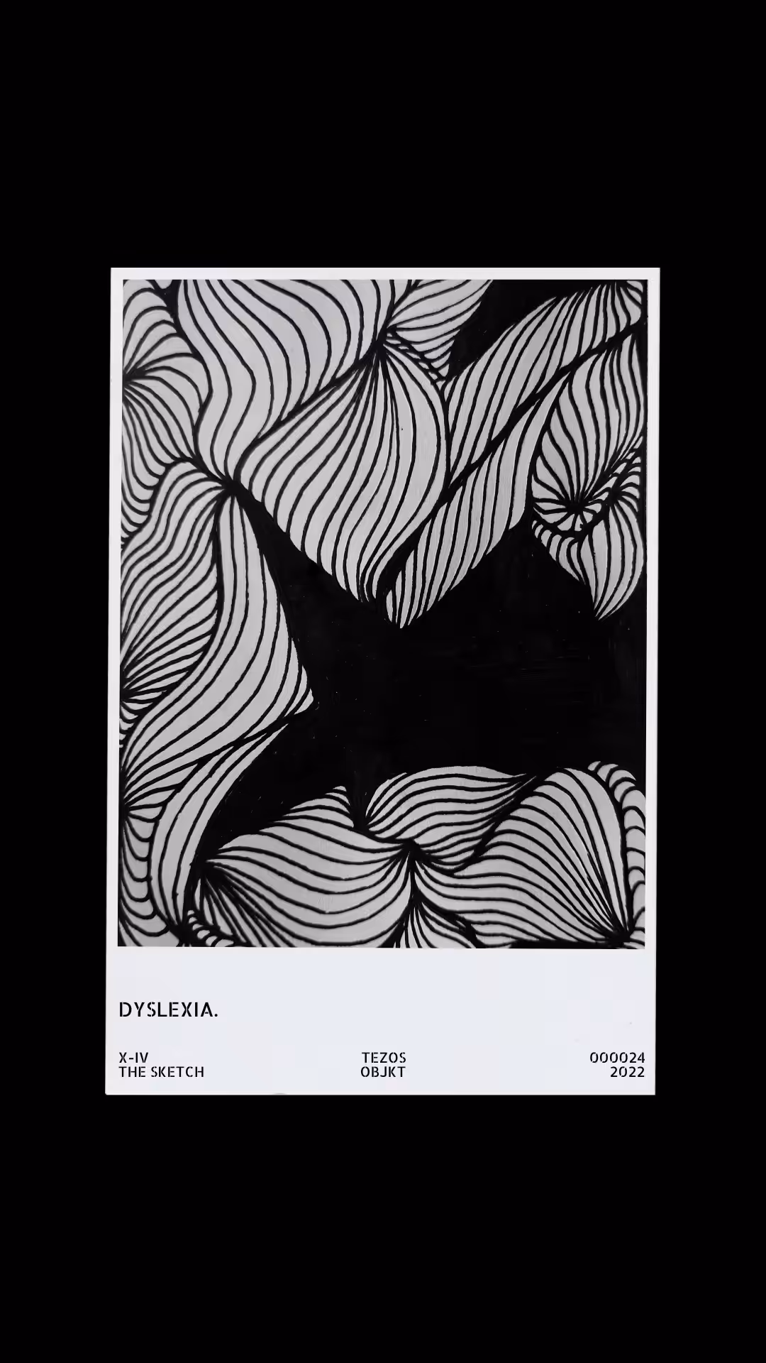 Dyslexia.