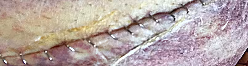 "A Beautiful Scar (Original Story)"