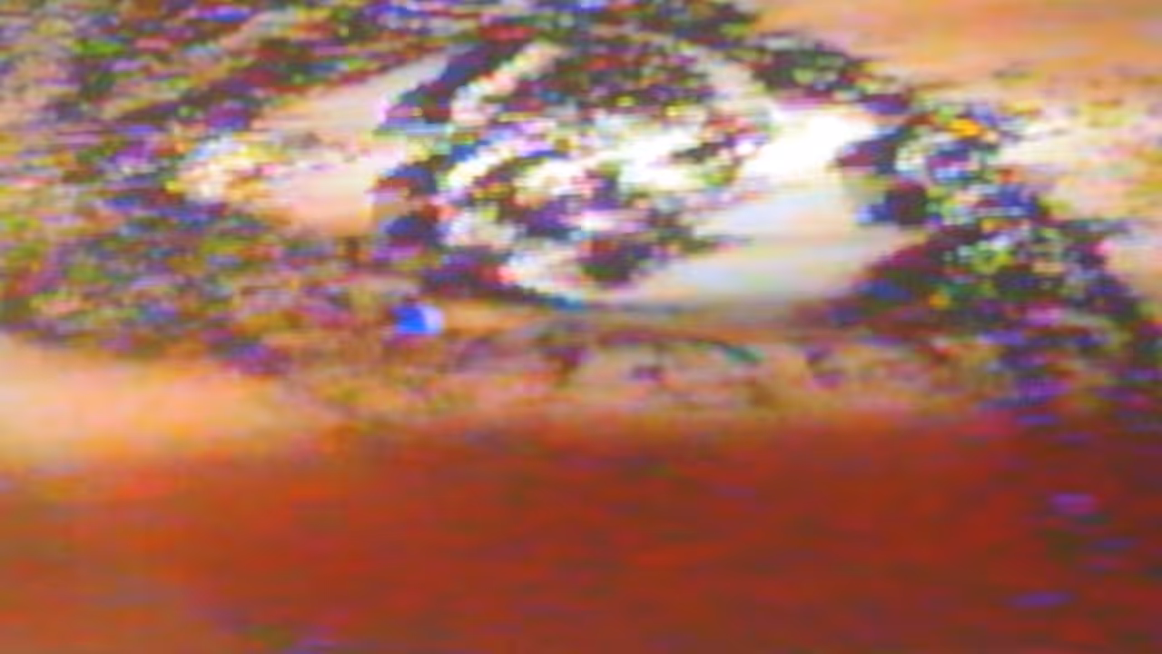 My Eye