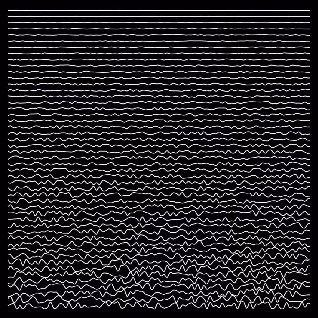 Ups and Downs