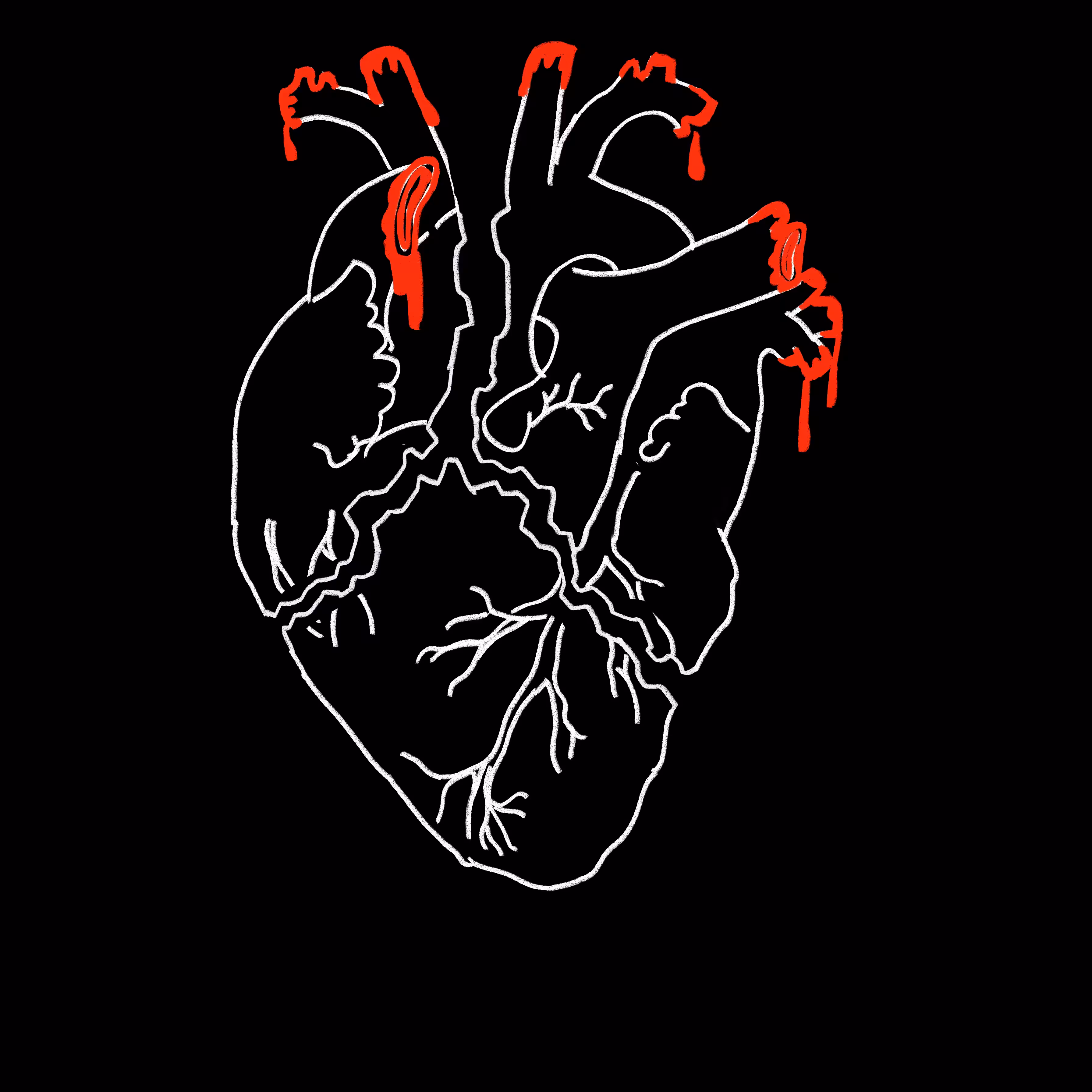 Broken Heart