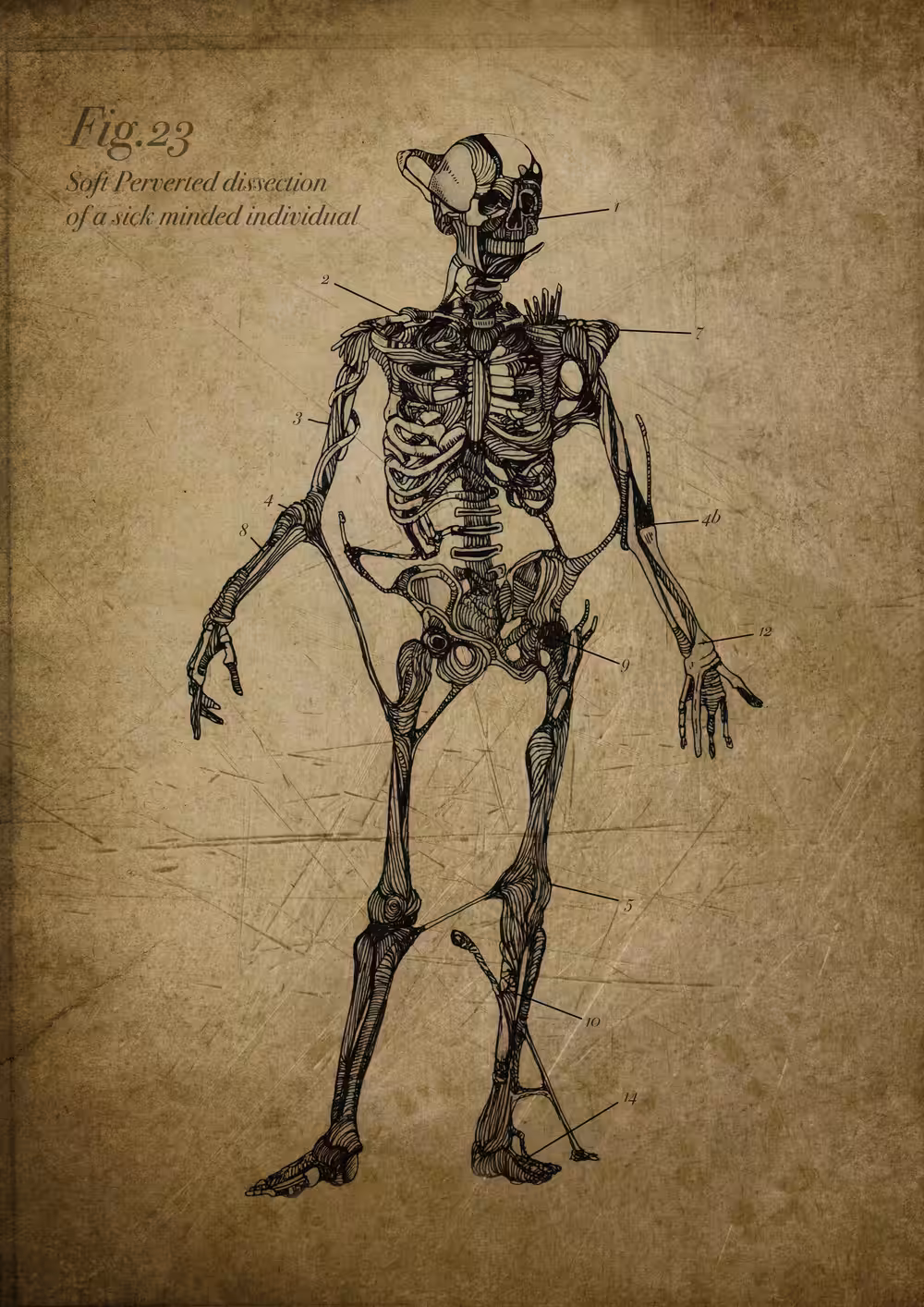 Skeletom