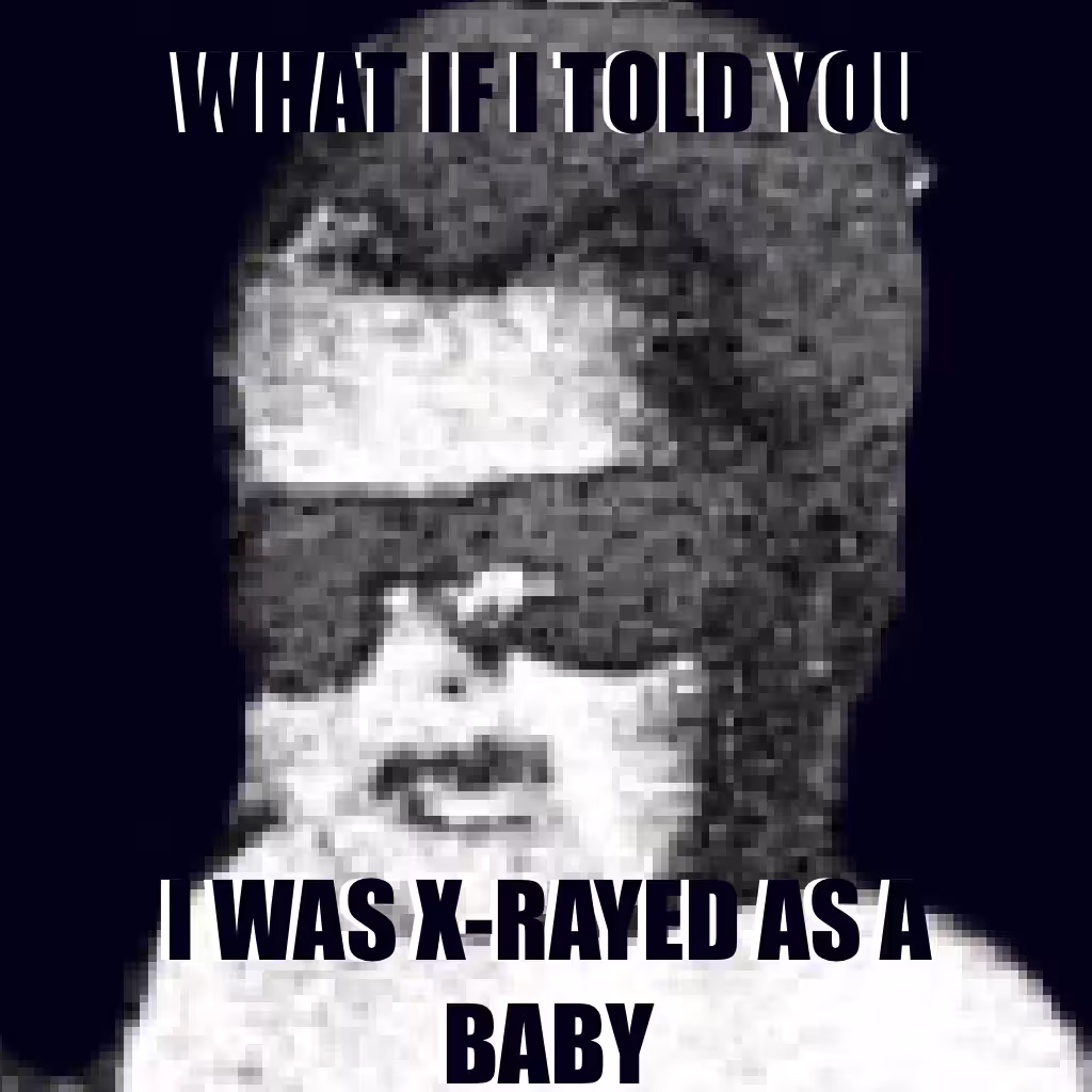 MATRIXRAY BABY 