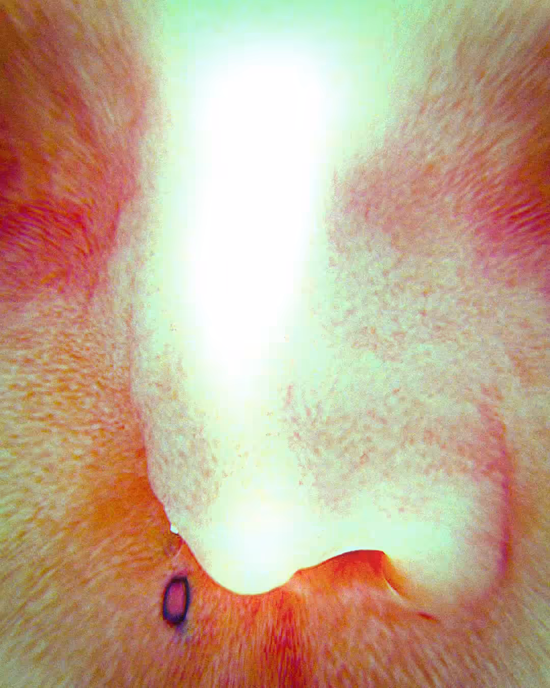 NOSE