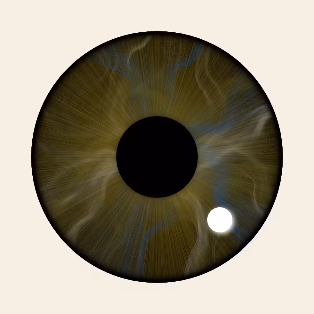 Iris Diffusion #9