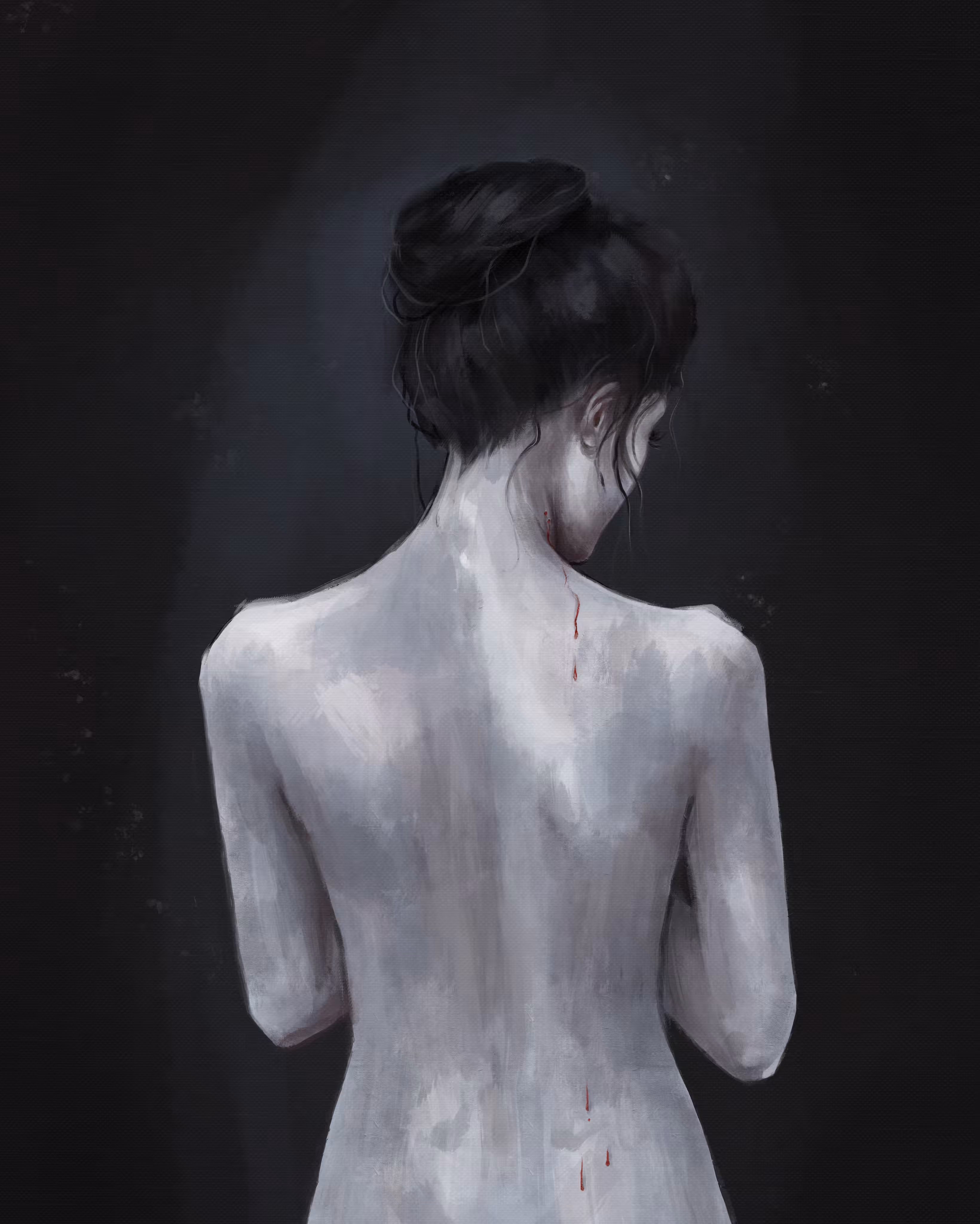 Bites