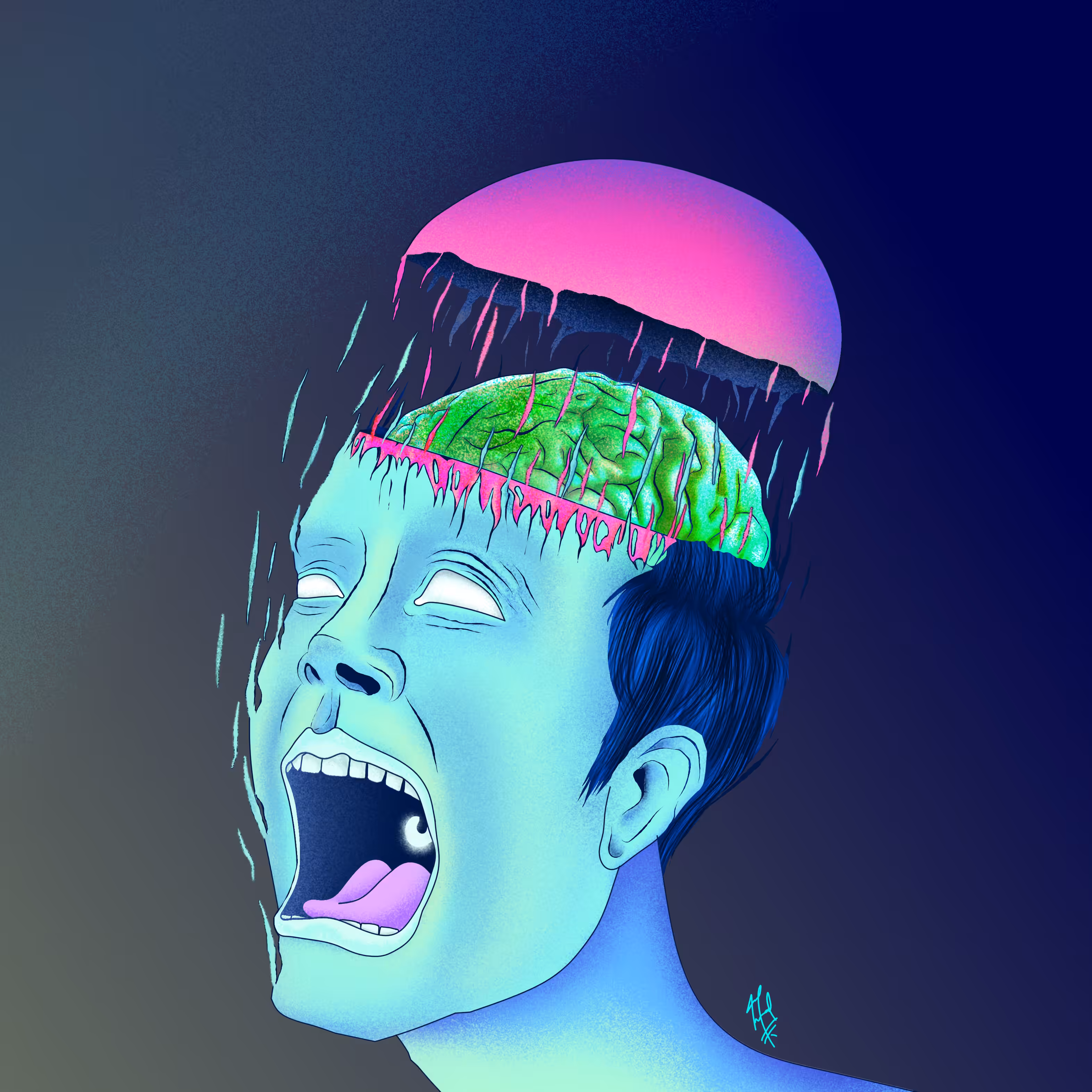 Extraction