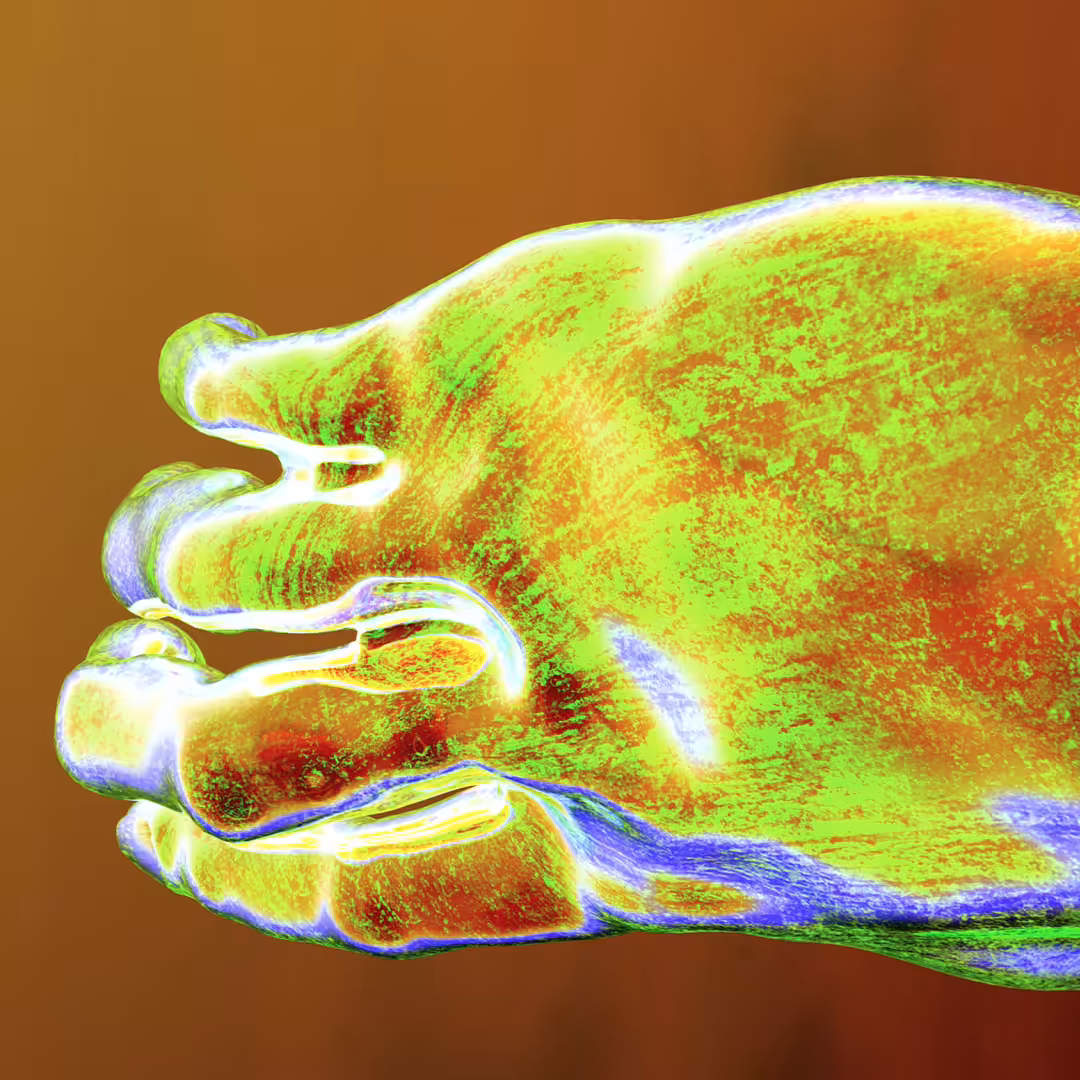 ReachingOut